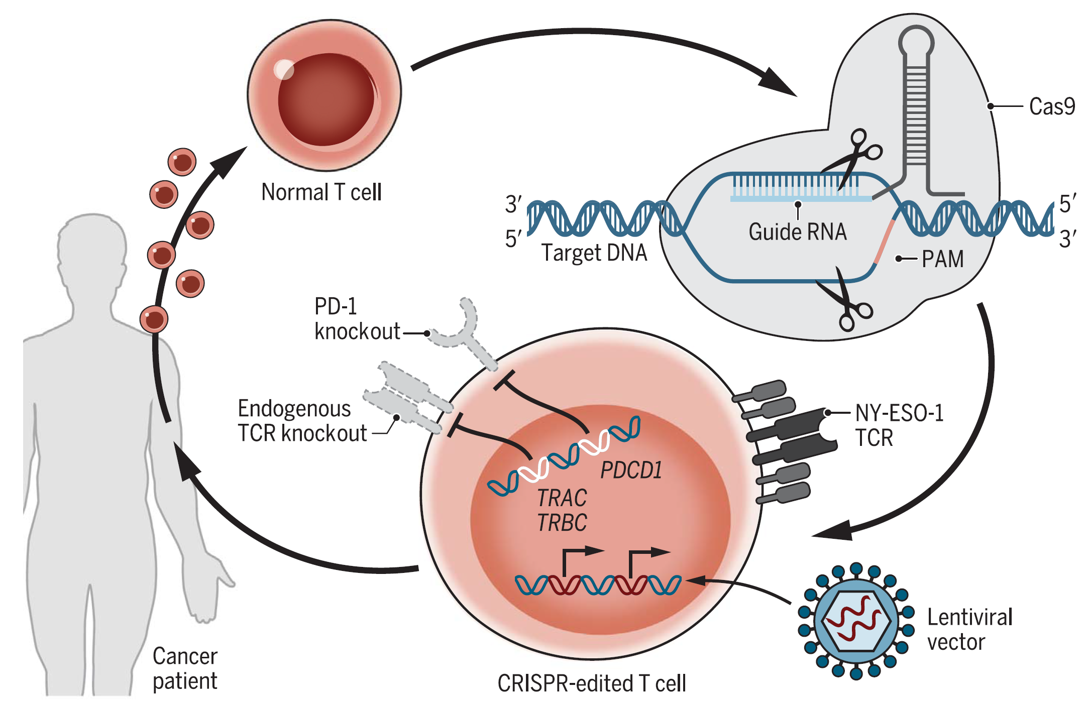 Figure 1 CRISPR-Cas9 engineering of T cells in cancer patients.png