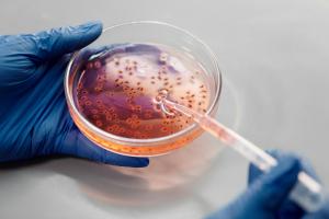 Clinical Applications of Whole Exome Sequencing in Rare Disease Diagnosis